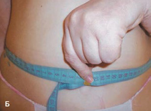 Cavitation-9-zhivot_300-220 (1).jpg Cavitation-9-zhivot_300-220 (1).jpg