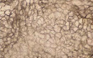 Cavitation-3_300-188.jpg Cavitation-3_300-188.jpg