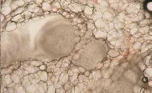 Cavitation-6_300-184.jpg Cavitation-6_300-184.jpg