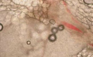 Cavitation-7_300-186.jpg Cavitation-7_300-186.jpg