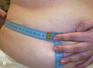 Cavitation-11-zhivot_300-220.jpg Cavitation-11-zhivot_300-220.jpg