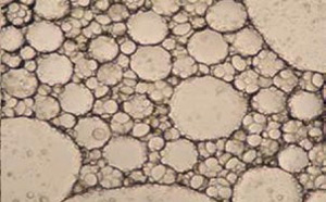 Cavitation-5_300-186.jpg Cavitation-5_300-186.jpg