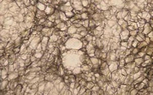 Cavitation-4_300-187.jpg Cavitation-4_300-187.jpg
