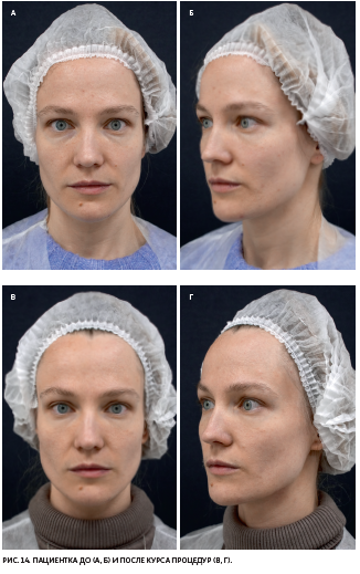 image4.png image4.png